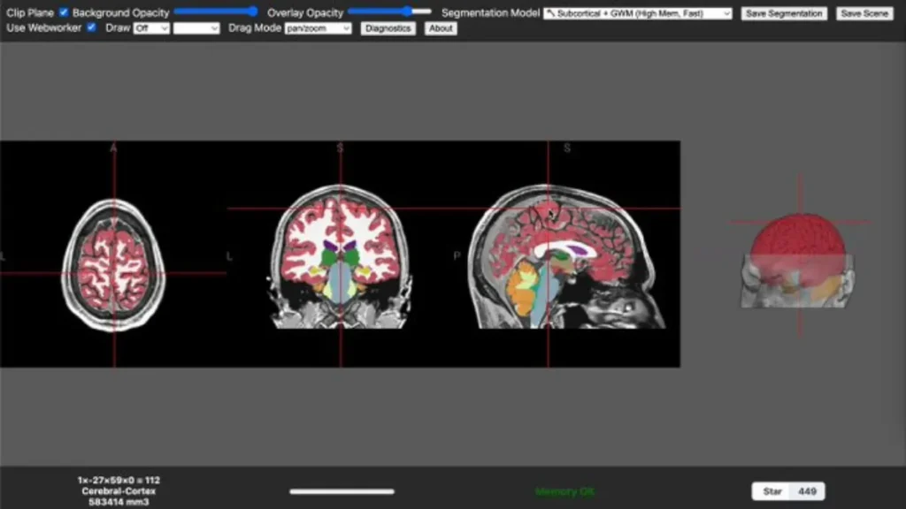 Brainchop MRI Tool, 3D MRI Segmentation in Browser, NIfTI Format MRI Analysis, Open-source MRI Segmentation, AI in Medical Imaging 2025,