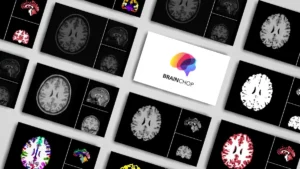 Brainchop: ब्राउज़र में चलने वाला ओपन-सोर्स 3D MRI सेगमेंटेशन टूल