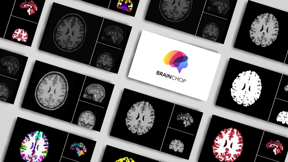 Brainchop MRI Tool, 3D MRI Segmentation in Browser, NIfTI Format MRI Analysis, Open-source MRI Segmentation, AI in Medical Imaging 2025,